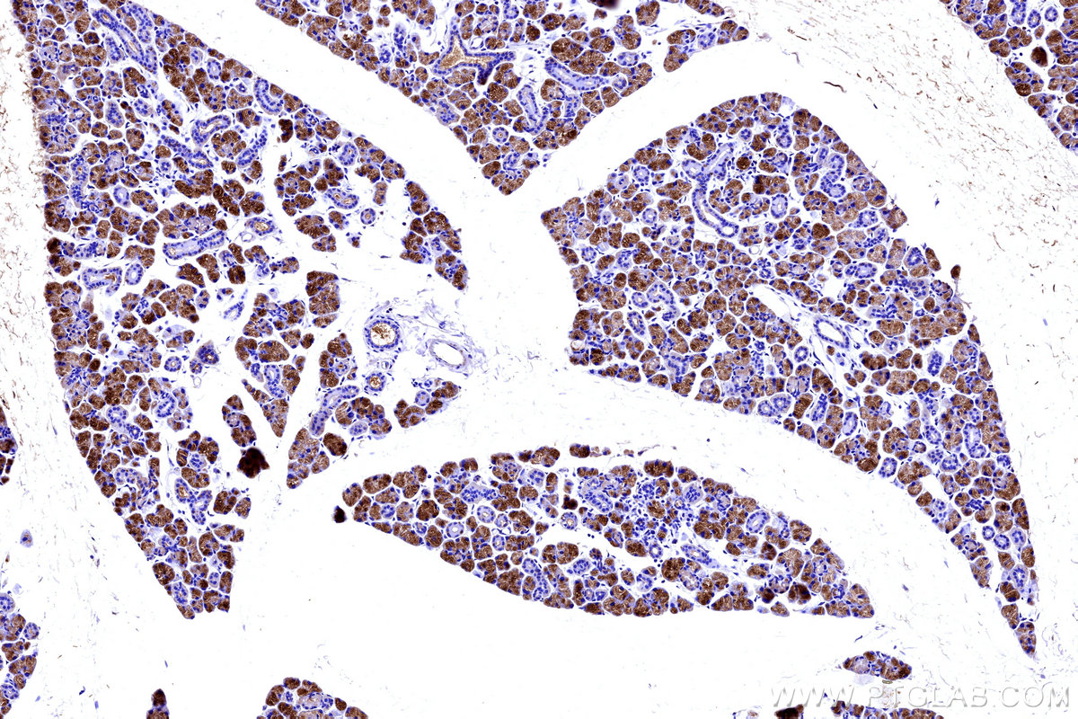 IHC staining of mouse salivary gland using 16261-1-AP (same clone as 16261-1-PBS) IHC staining of mouse salivary gland using 16261-1-AP (same clone as 16261-1-PBS)