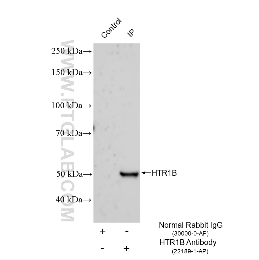 IP experiment of mouse placenta using 22189-1-AP