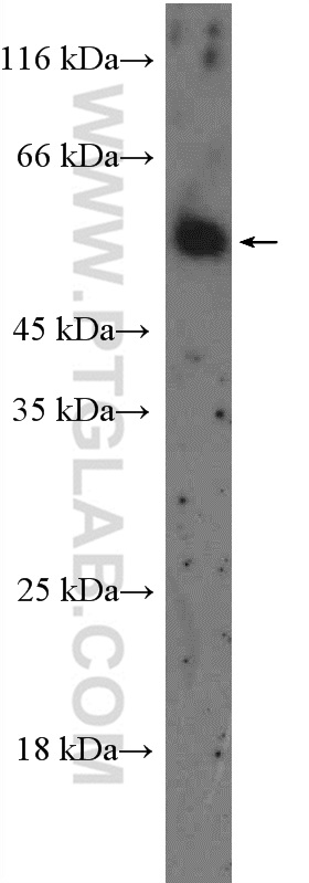 WB analysis of mouse brain using 26408-1-AP