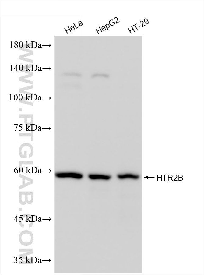 WB analysis using 87277-1-RR