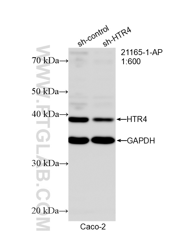 WB analysis of Caco-2 using 21165-1-AP WB analysis of Caco-2 using 21165-1-AP