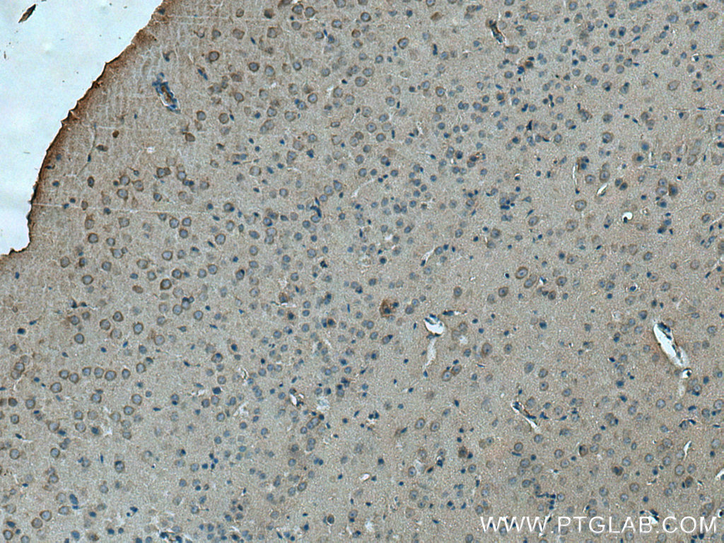 IHC staining of mouse brain using 28221-1-AP