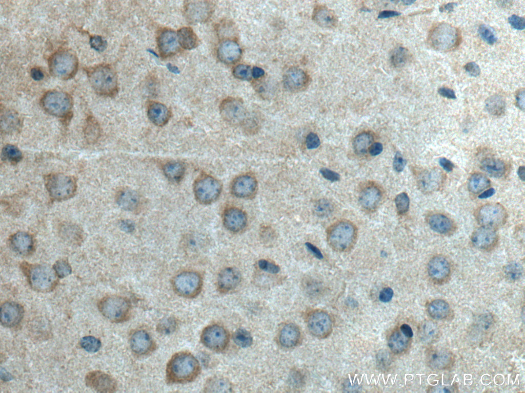 IHC staining of mouse brain using 28221-1-AP