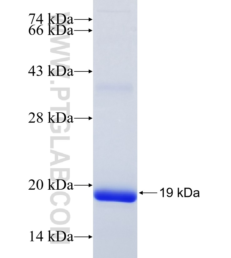 HTR5A fusion protein Ag21621 SDS-PAGE HTR5A fusion protein Ag21621 SDS-PAGE