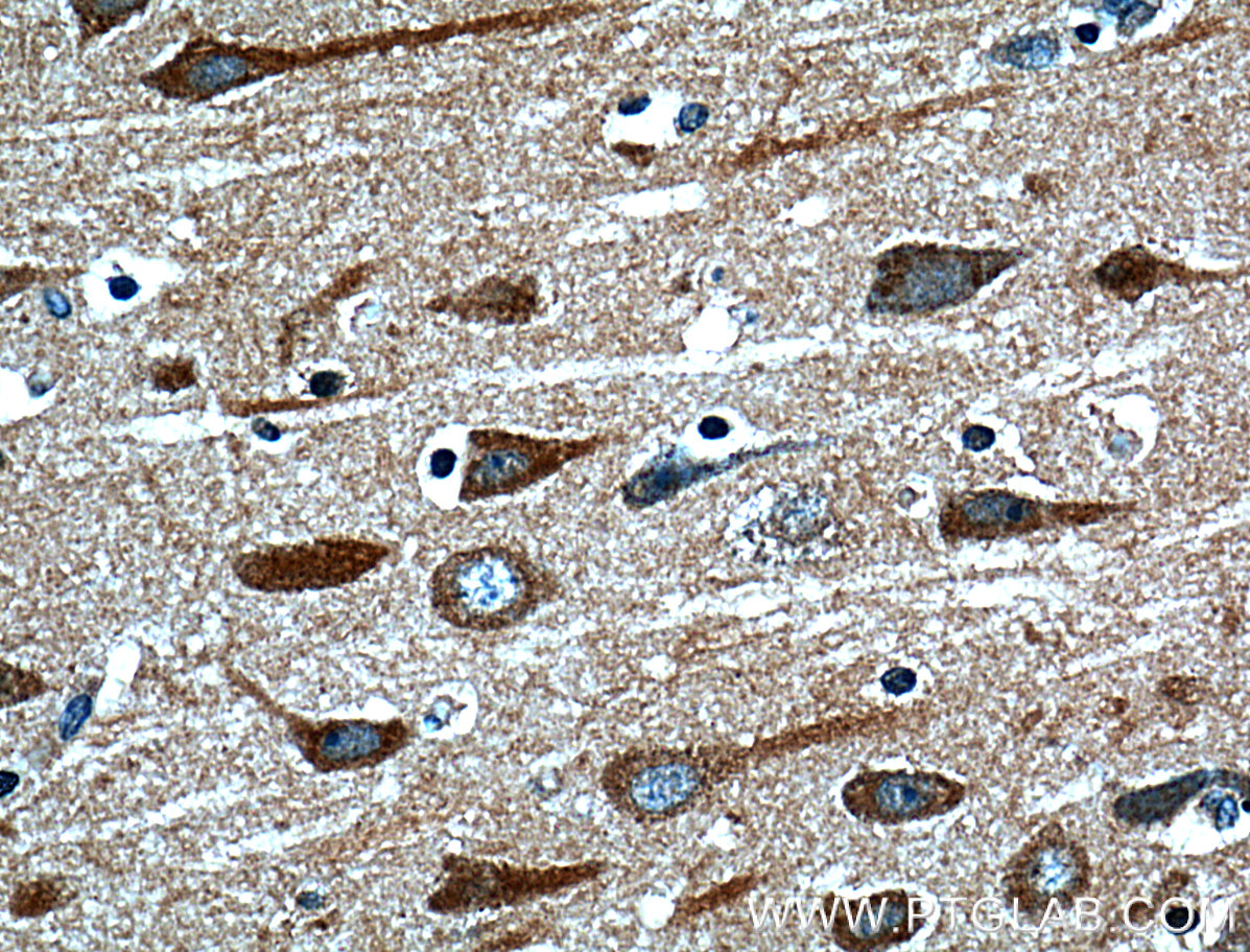 IHC staining of human brain using 13830-1-AP