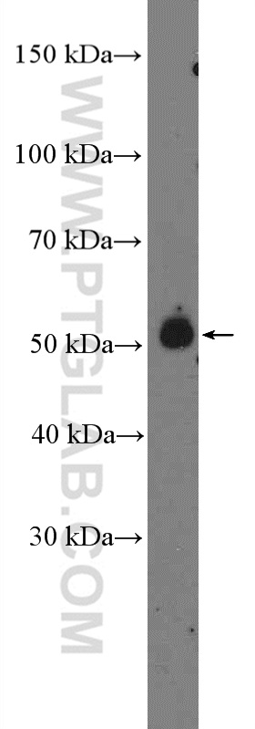 WB analysis of mouse brain using 13830-1-AP (same clone as 13830-1-PBS)