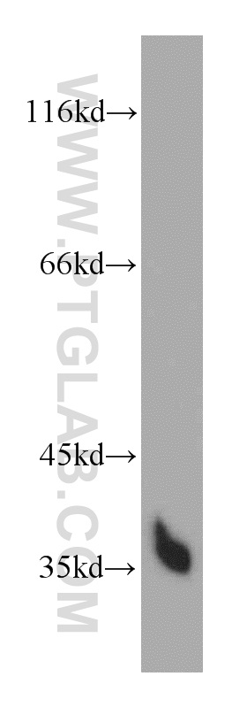 WB analysis of L02 using 55011-1-AP