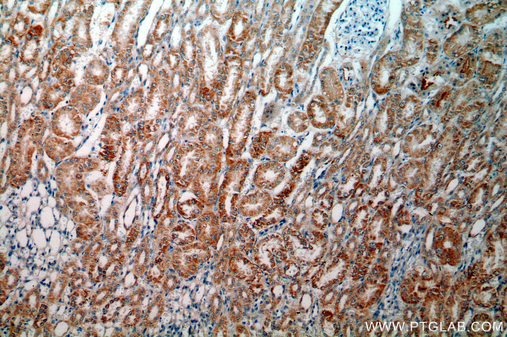 IHC staining of human kidney using 15775-1-AP