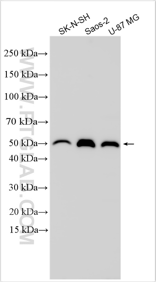 WB analysis using 31369-1-AP