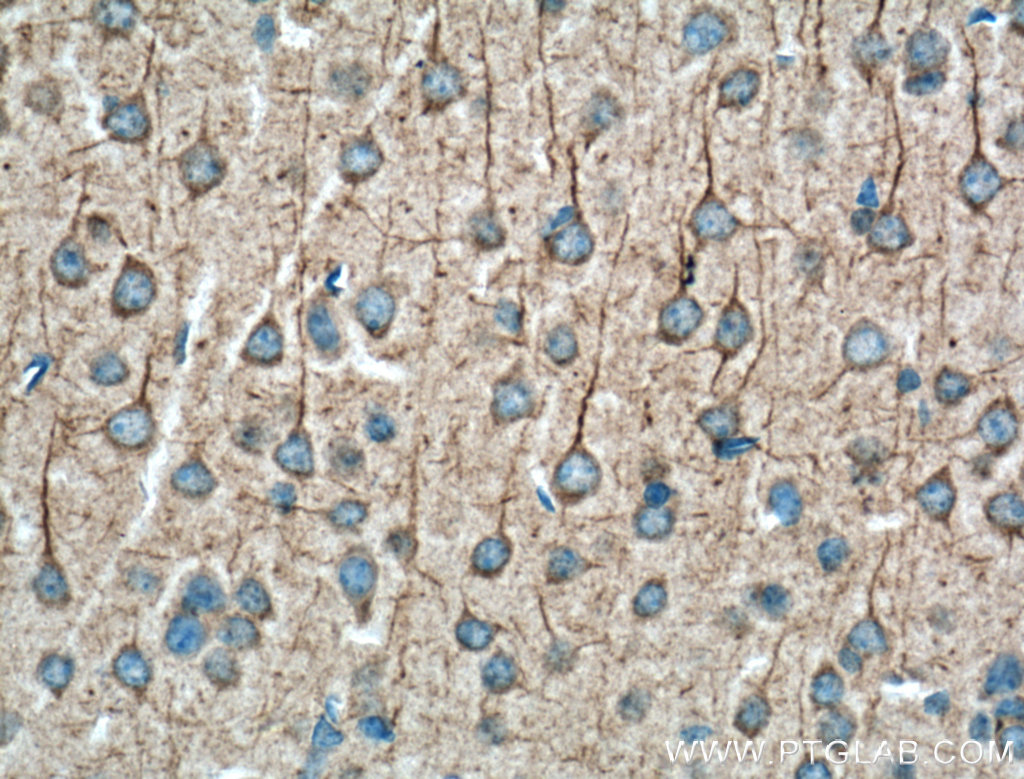IHC staining of mouse brain using 19957-1-AP