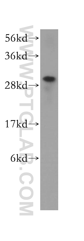 WB analysis of BxPC-3 using 11223-1-AP