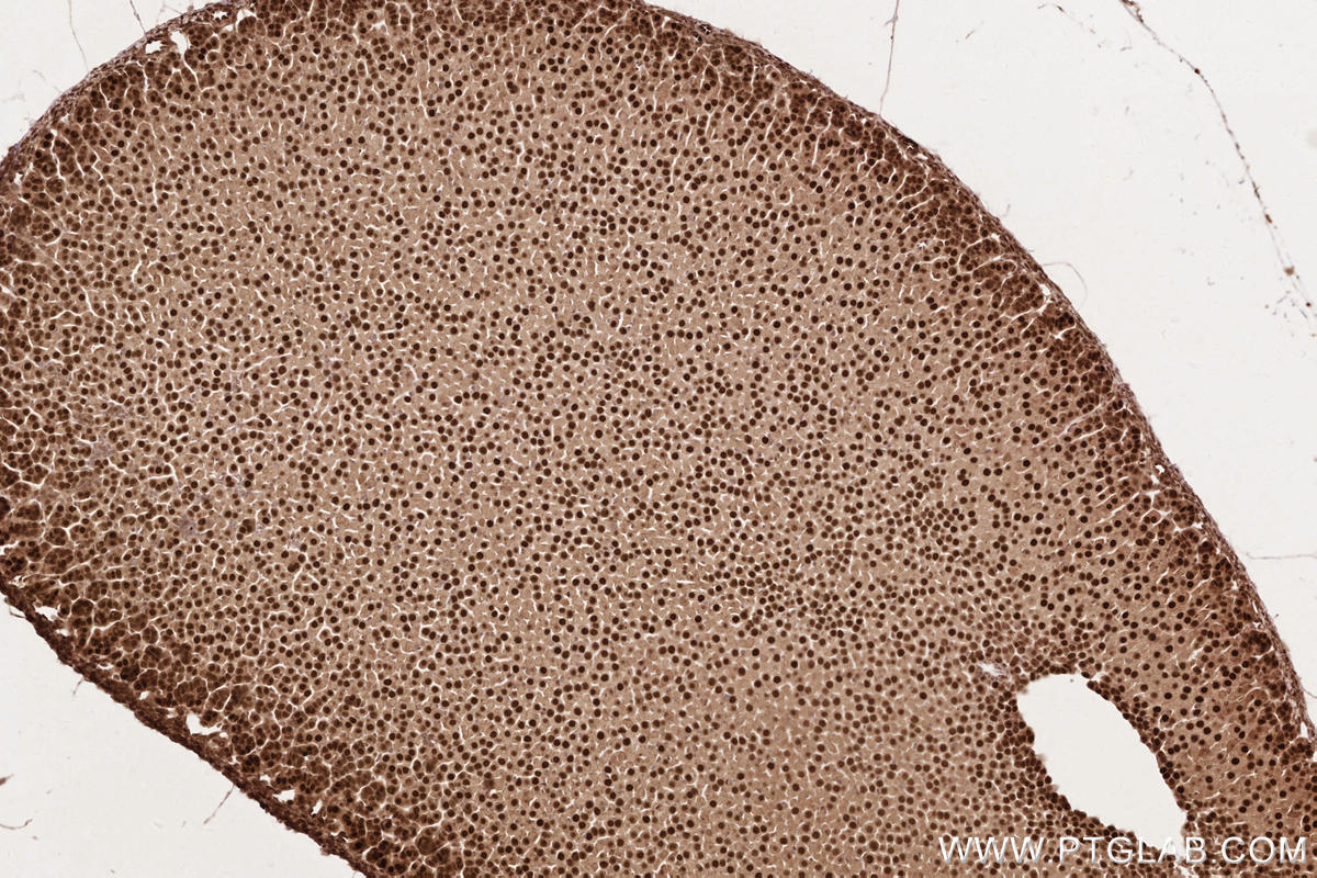IHC staining of mouse adrenal gland using 19430-1-AP