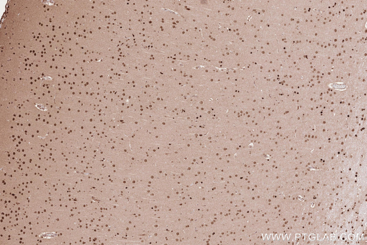 IHC staining of rat brain using 19430-1-AP
