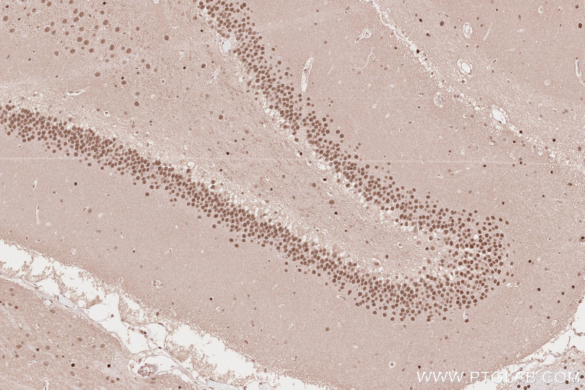 IHC staining of rat brain using 19430-1-AP