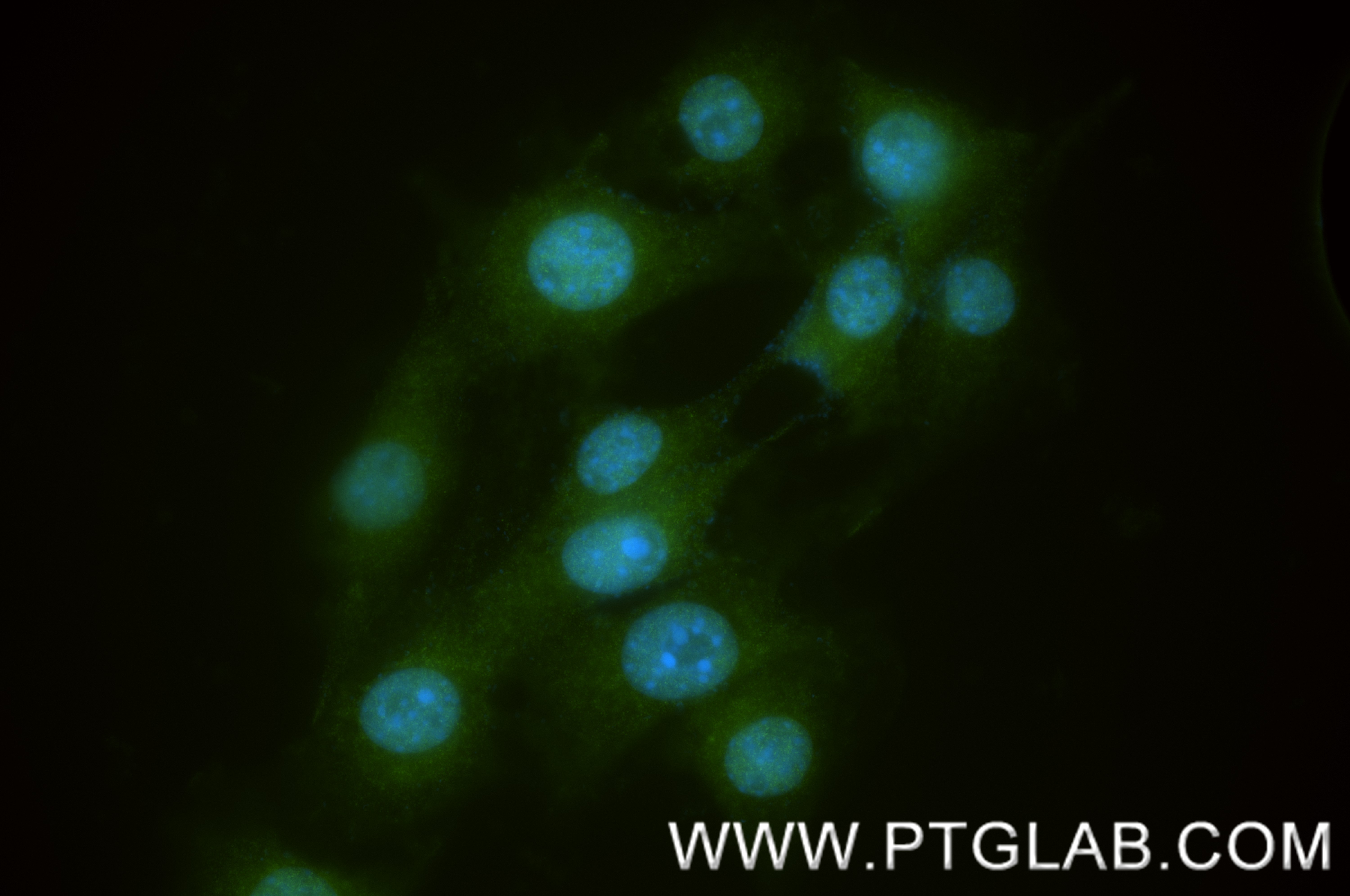 IF Staining of NIH/3T3 using 85177-3-RR