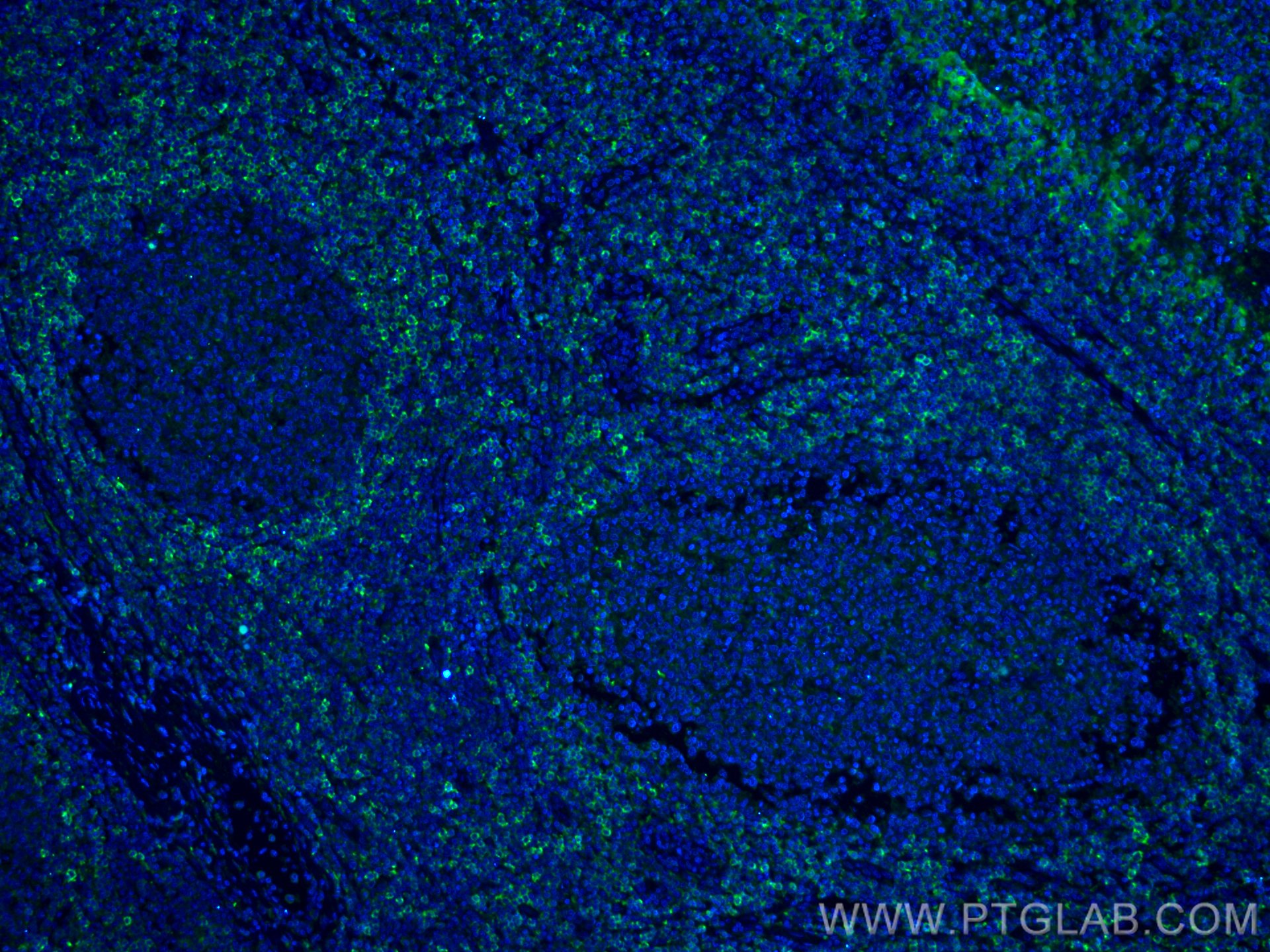 IF Staining of human tonsillitis using 66449-1-Ig (same clone as 66449-1-PBS)