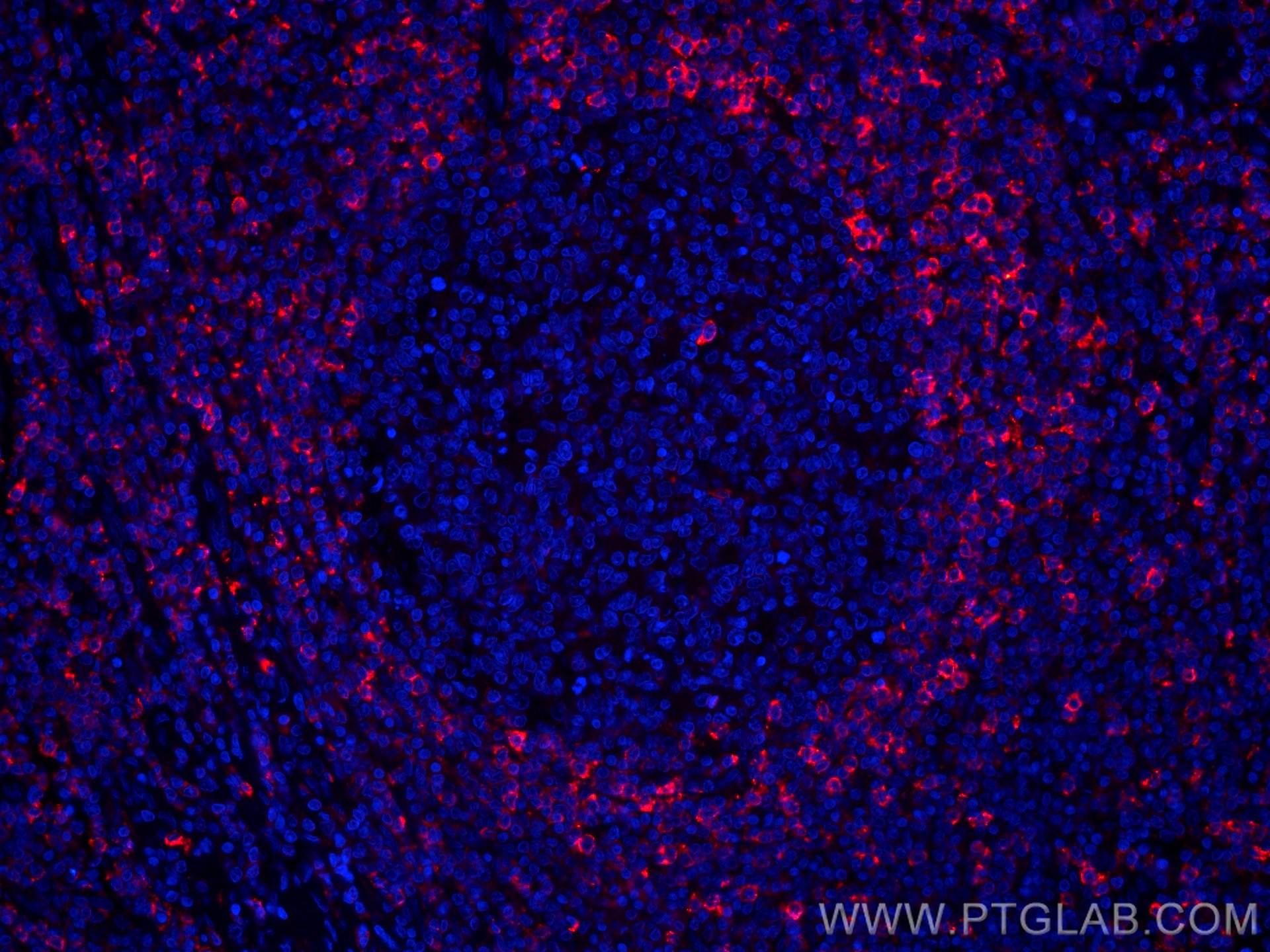 IF Staining of human tonsillitis using CL594-66449