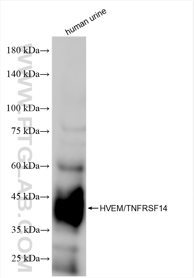 WB analysis of human urine using 81078-6-RR