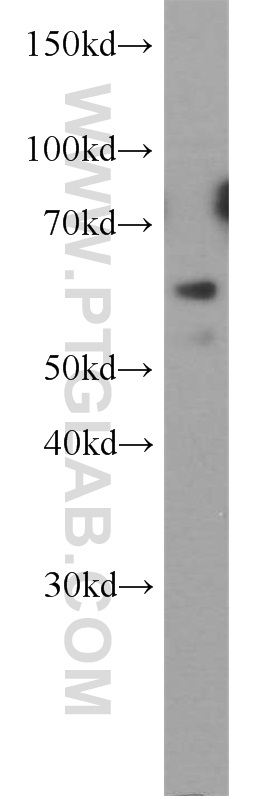 HYAL2 Polyclonal antibody