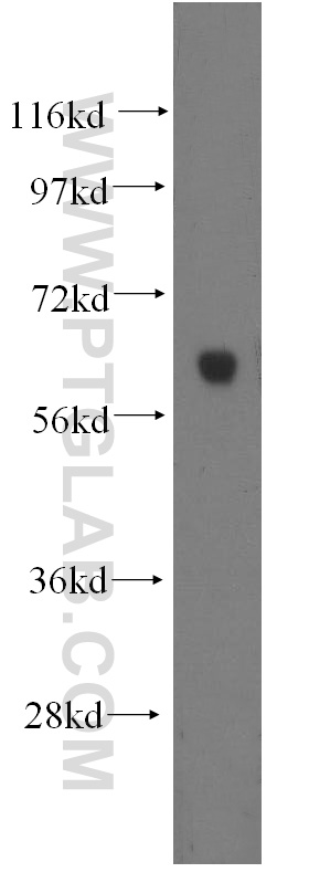 HYAL2 Polyclonal antibody