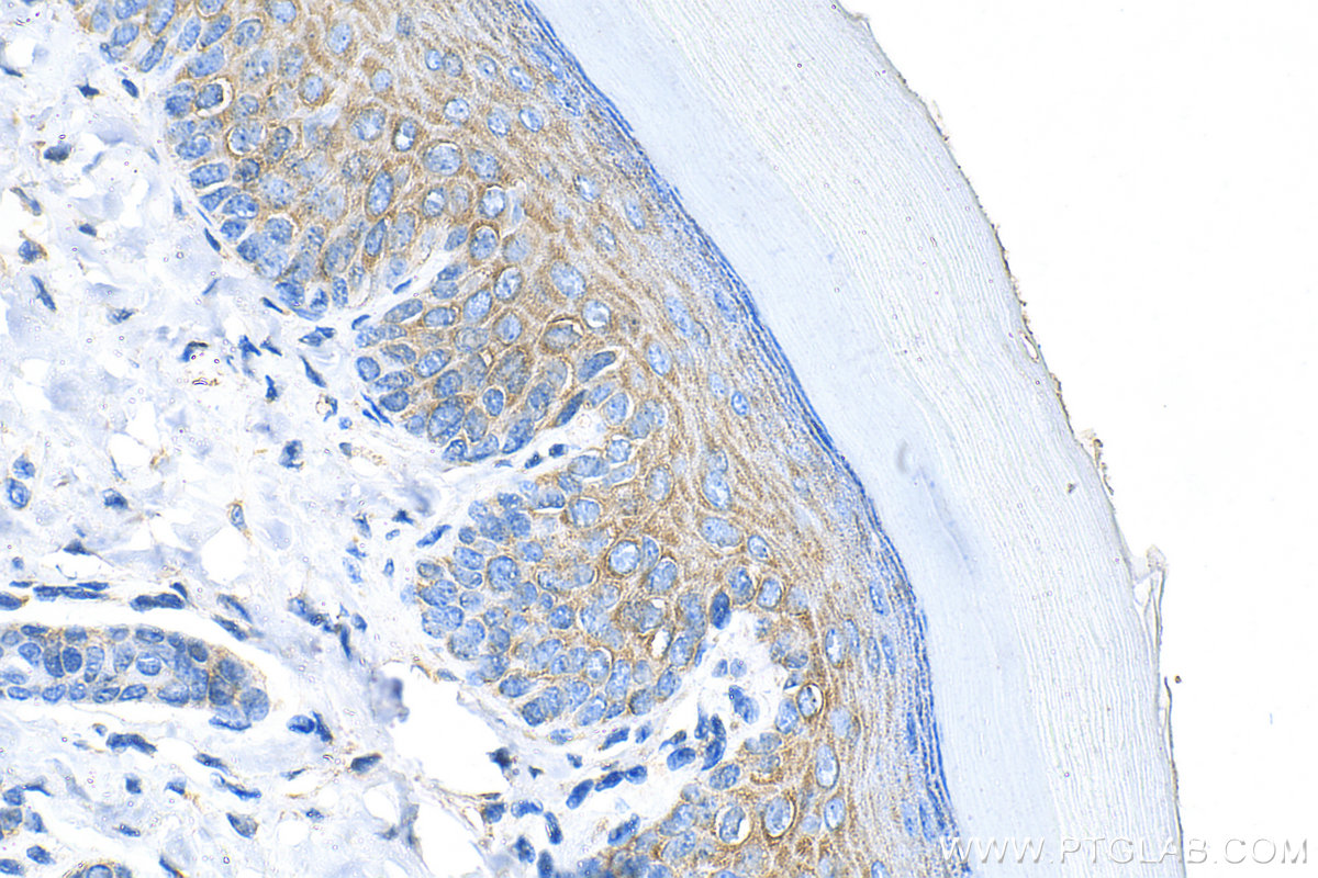 Immunohistochemical analysis of paraffin-embedded mouse skin tissue slide using 18139-1-AP (HYAL4 antibody) at dilution of 1:400 (under 40x lens). Heat mediated antigen retrieval with Tris-EDTA buffer (pH 9.0). IHC staining of mouse skin using 18139-1-AP