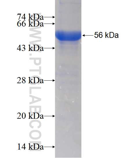 HYAL4 fusion protein Ag12886 SDS-PAGE HYAL4 fusion protein Ag12886 SDS-PAGE