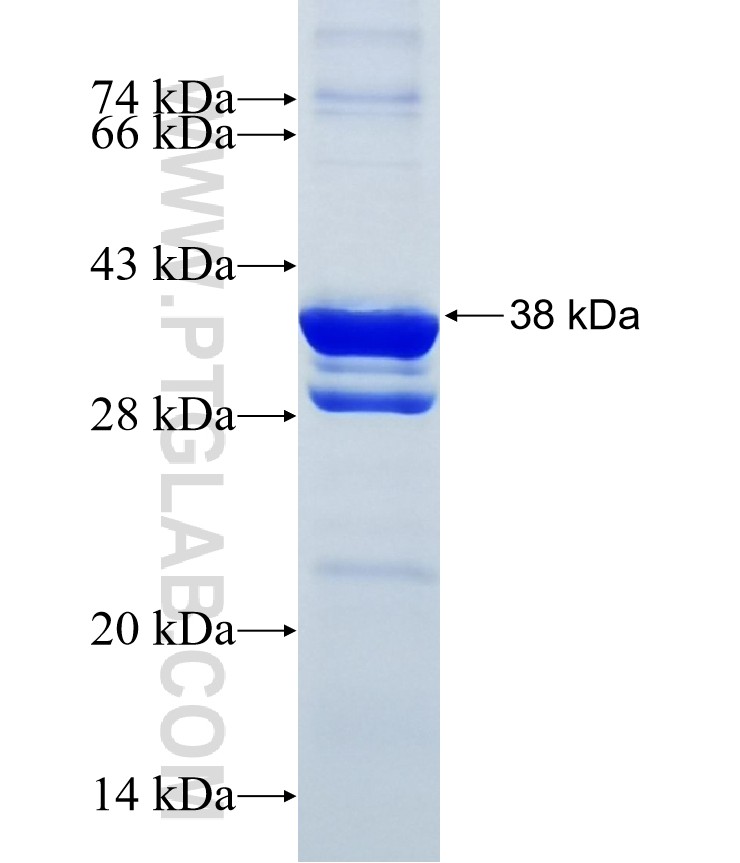 HYLS1 fusion protein Ag8306 SDS-PAGE HYLS1 fusion protein Ag8306 SDS-PAGE