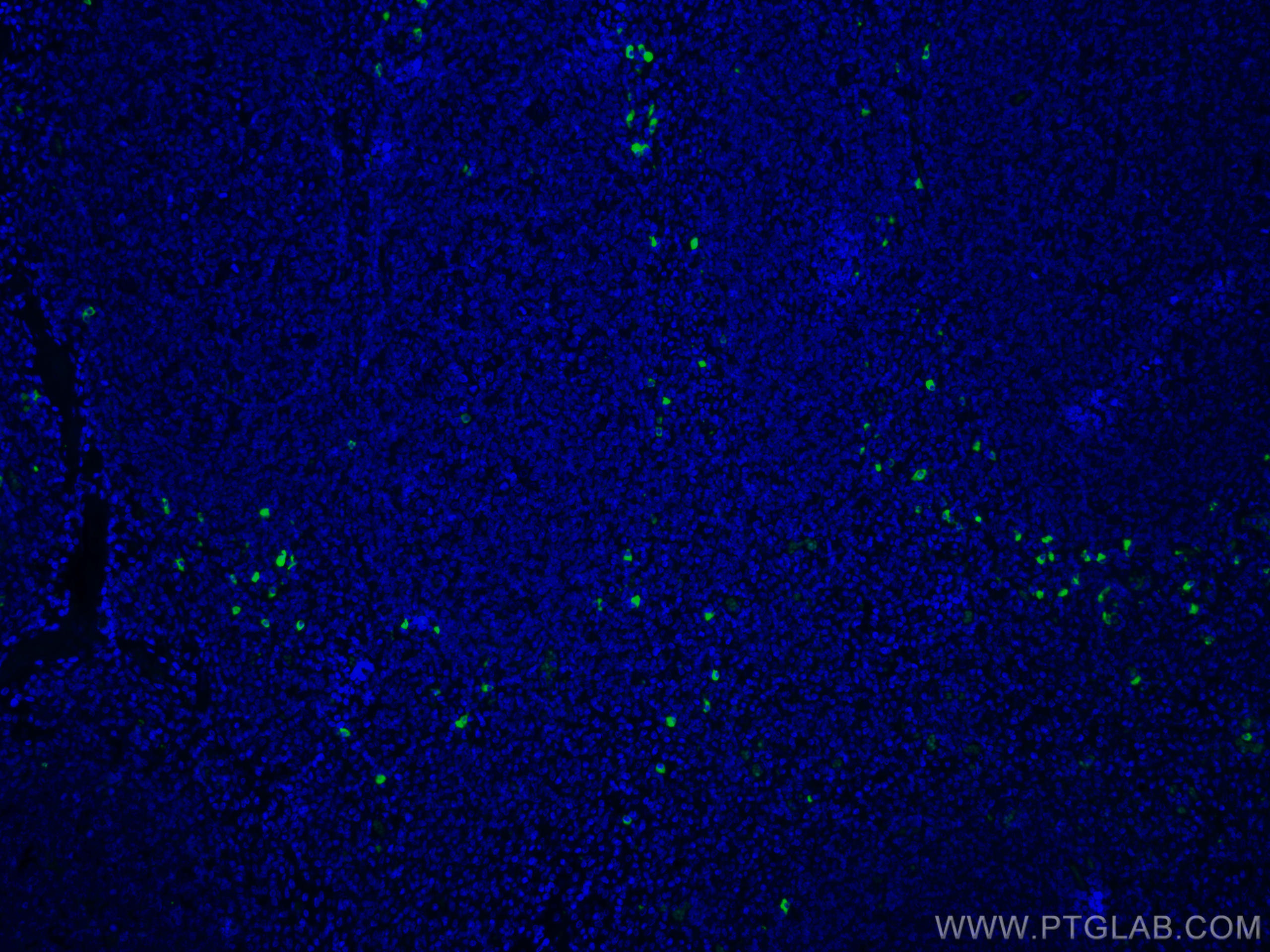 IF Staining of human tonsillitis using CL488-66408