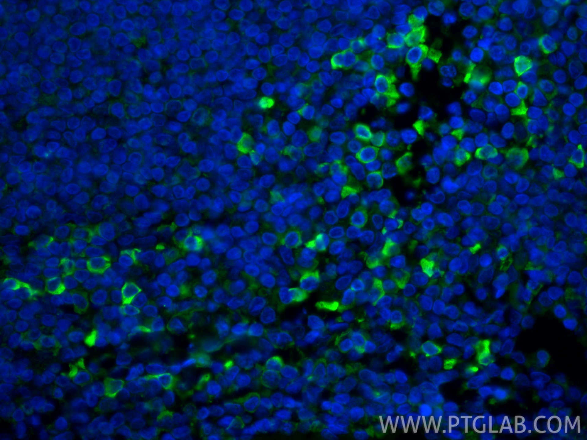 IF Staining of human tonsillitis using CL488-66408 IF Staining of human tonsillitis using CL488-66408
