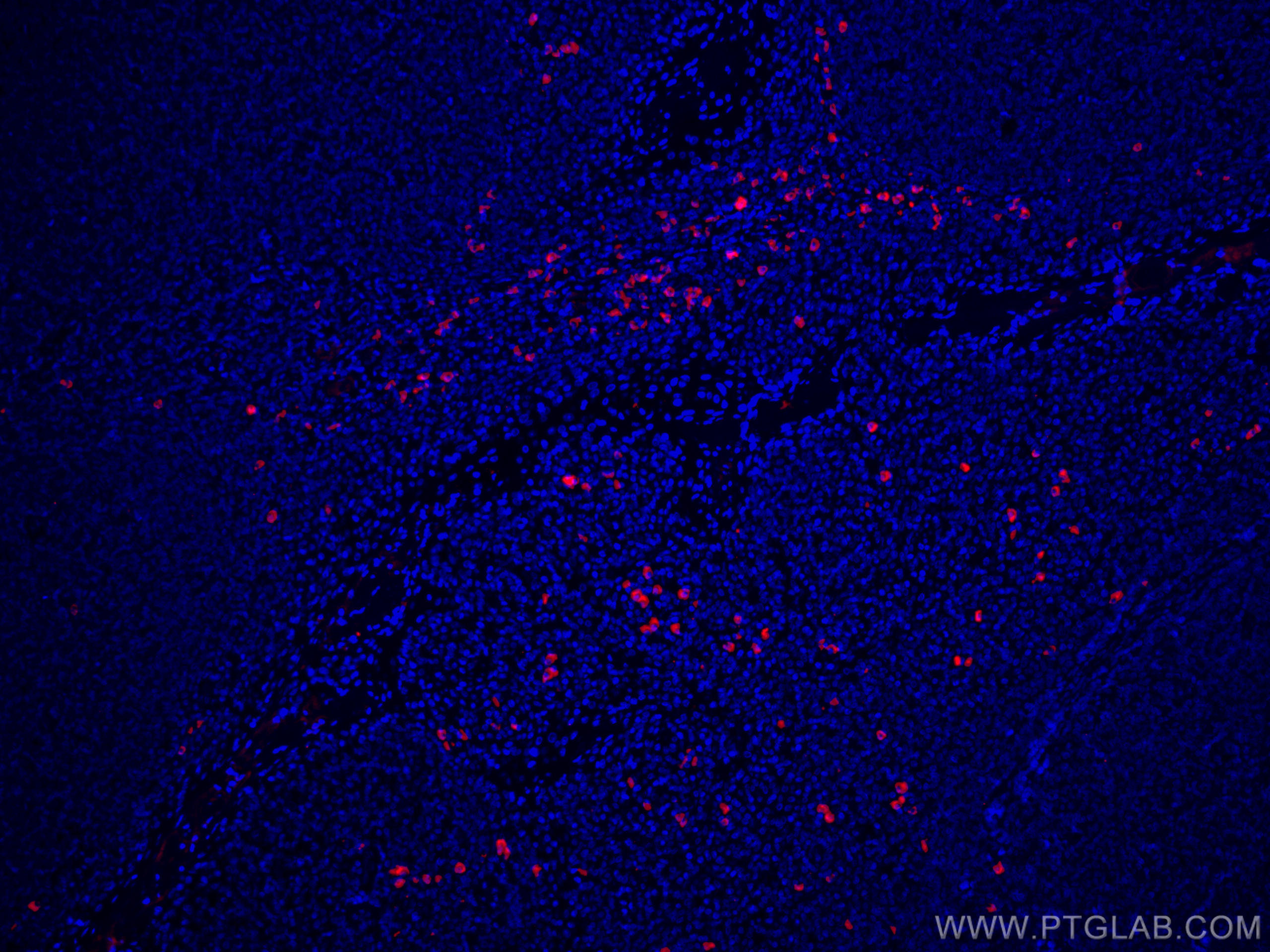 IF Staining of human tonsillitis using CL594-66408