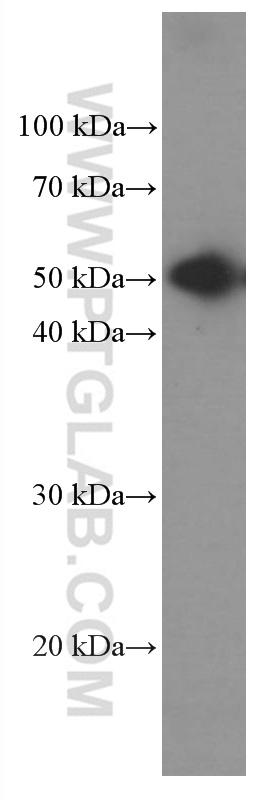 WB analysis of rabbit serum using 66467-1-Ig