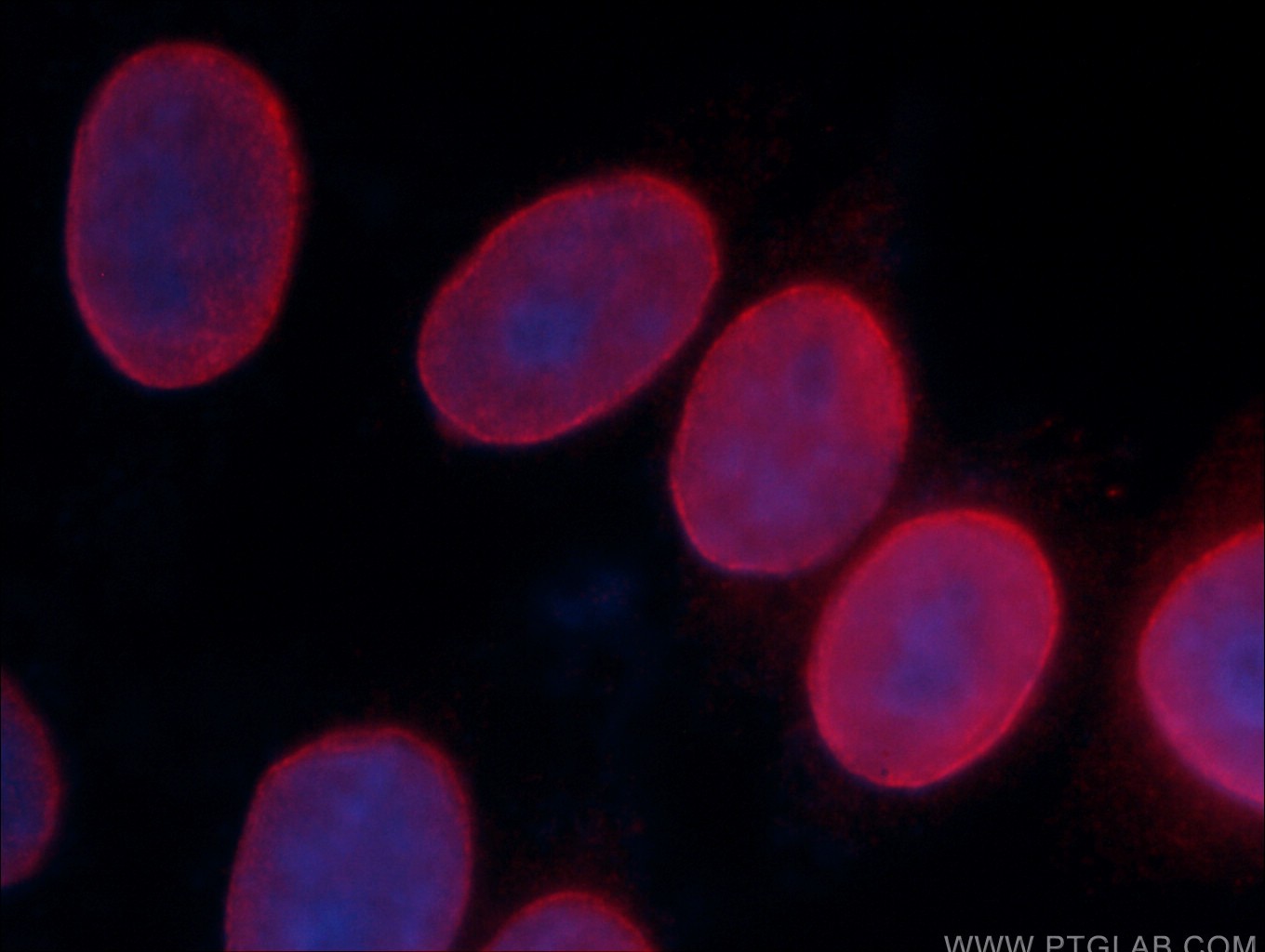 IF Staining of HeLa using CL594-66467