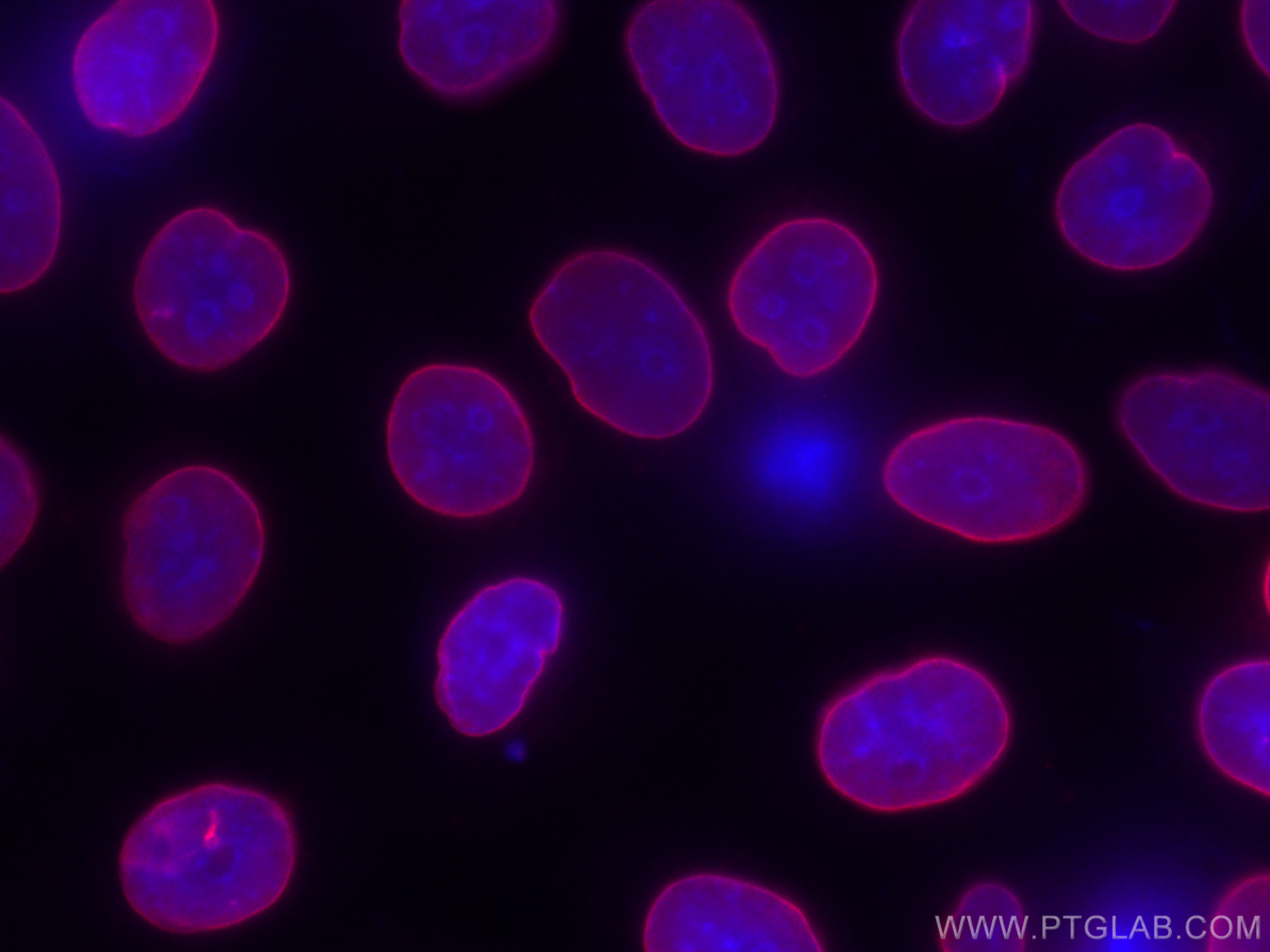 IF Staining of HeLa using CL647-66467