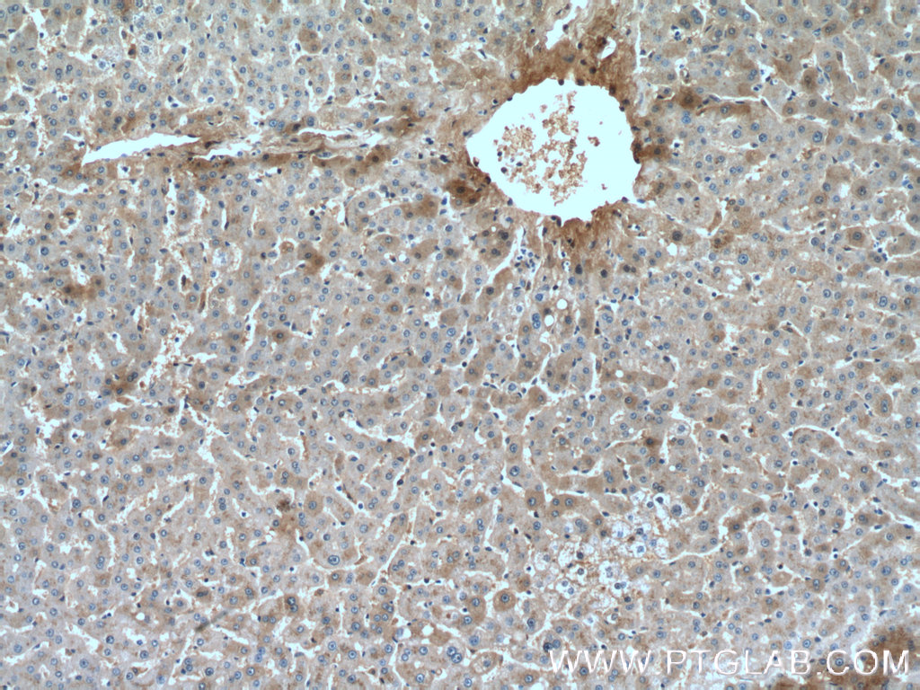 IHC staining of human liver using 66479-1-Ig