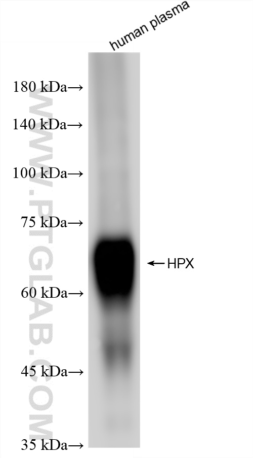 human plasma were subjected to SDS PAGE followed by western blot with 86395-3-RR (HPX antibody) at dilution of 1:10000 incubated at room temperature for 1.5 hours. WB analysis of human plasma using 86395-3-RR