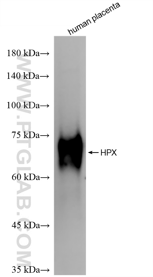human placenta tissue were subjected to SDS PAGE followed by western blot with 86395-3-RR (HPX antibody) at dilution of 1:10000 incubated at room temperature for 1.5 hours. WB analysis of human placenta using 86395-3-RR