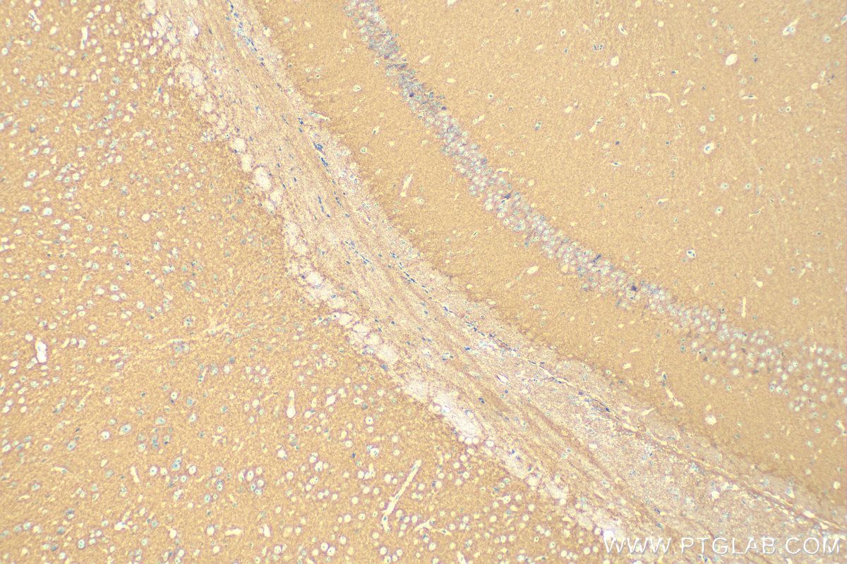 Hexokinase 1