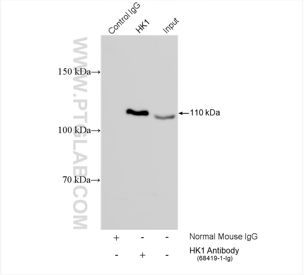 IP experiment of HeLa using 68419-1-Ig