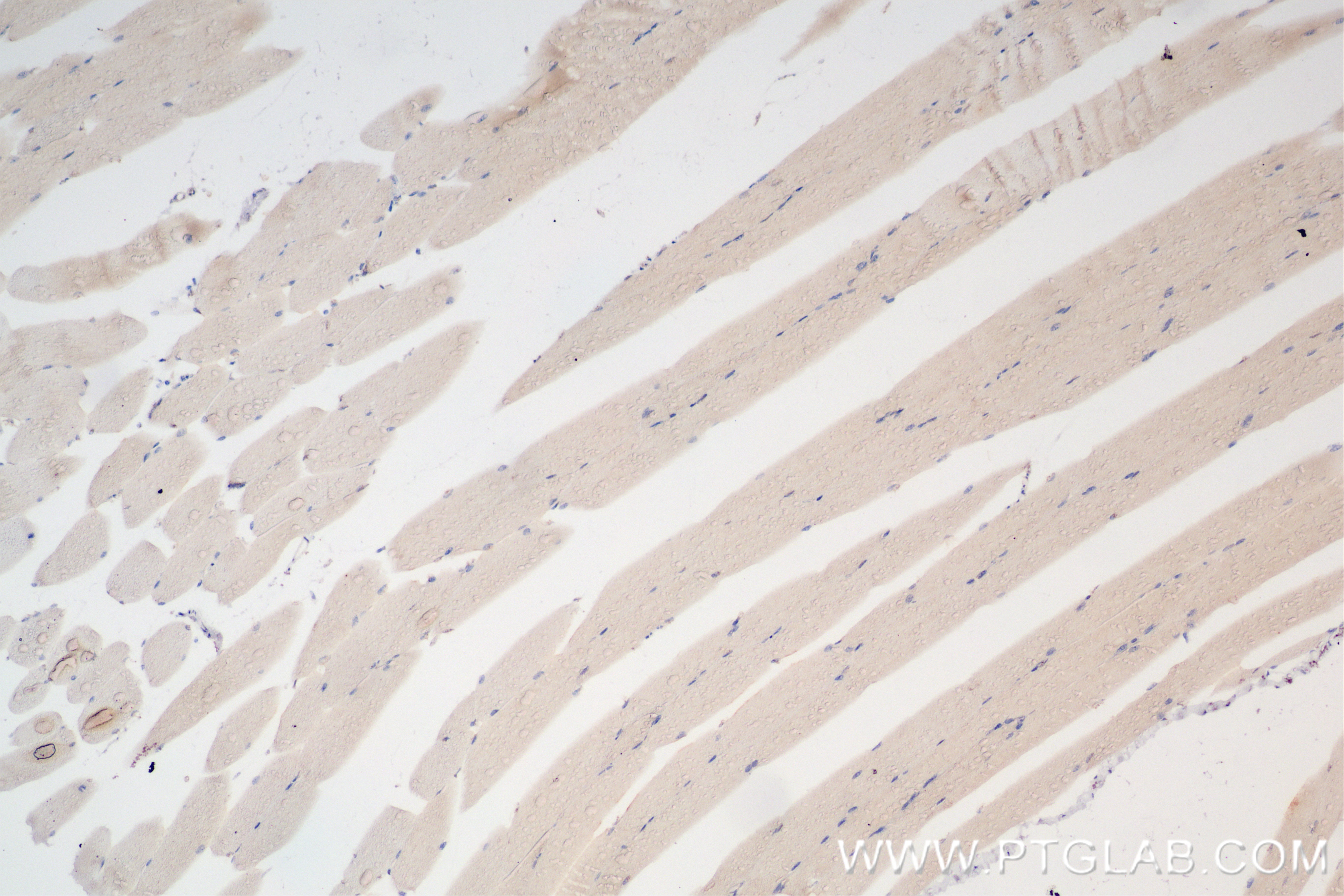 IHC staining of mouse skeletal muscle using 85875-1-RR (same clone as 85875-1-PBS)
