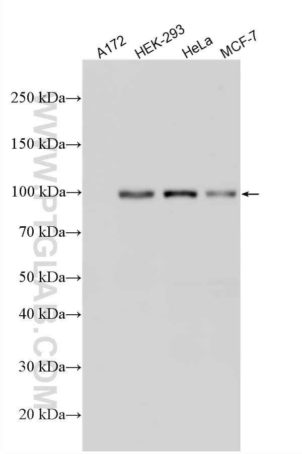 WB analysis using 85875-1-RR