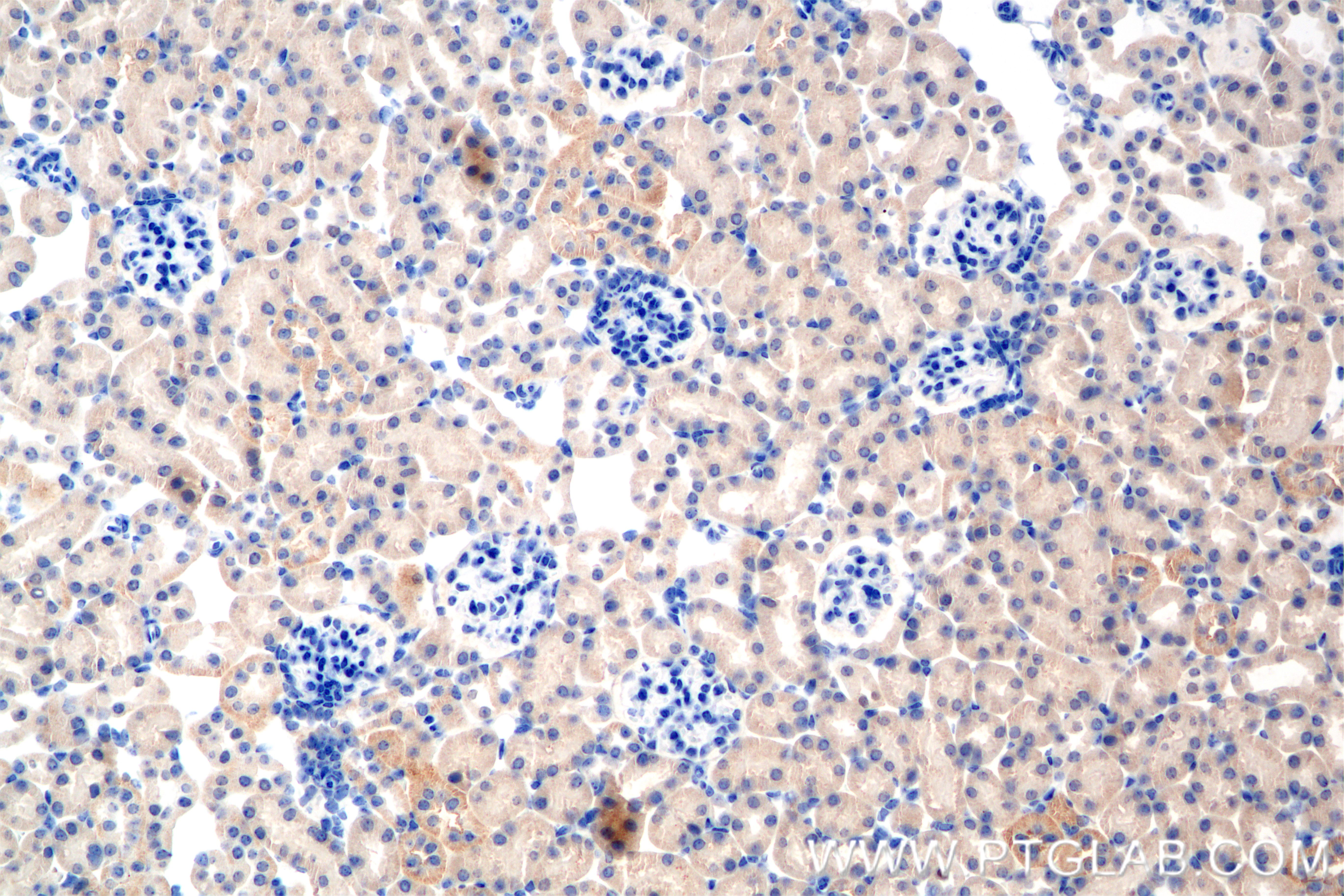 IHC staining of mouse kidney using 82989-4-RR