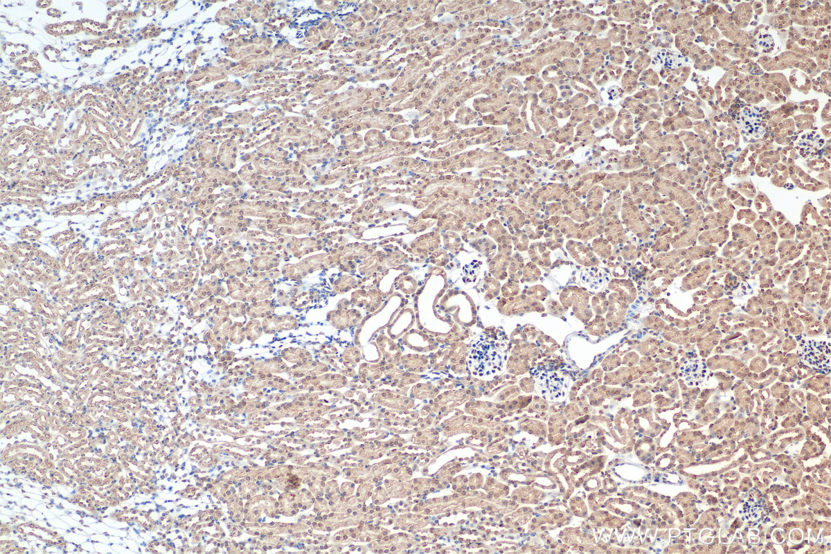 IHC staining of mouse kidney using 82989-6-RR