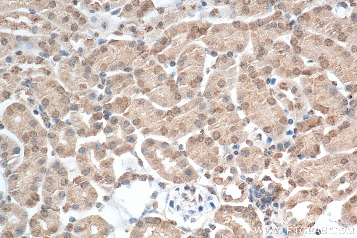 IHC staining of mouse kidney using 82989-6-RR