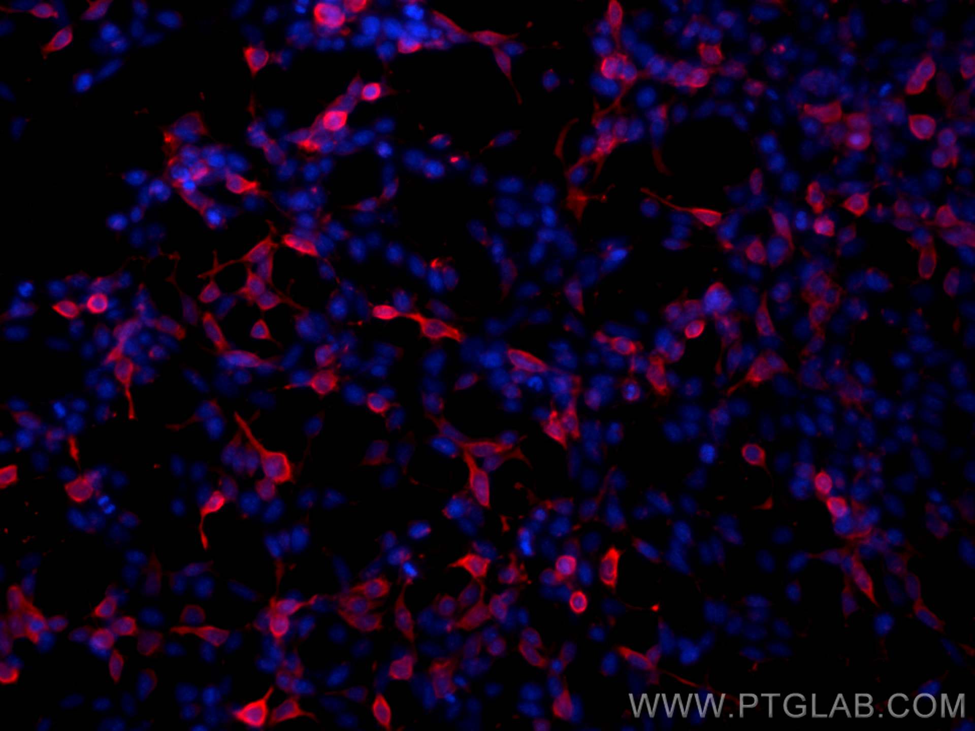 IF Staining of Transfected HEK-293 using 66005-1-Ig (same clone as 66005-1-PBS)