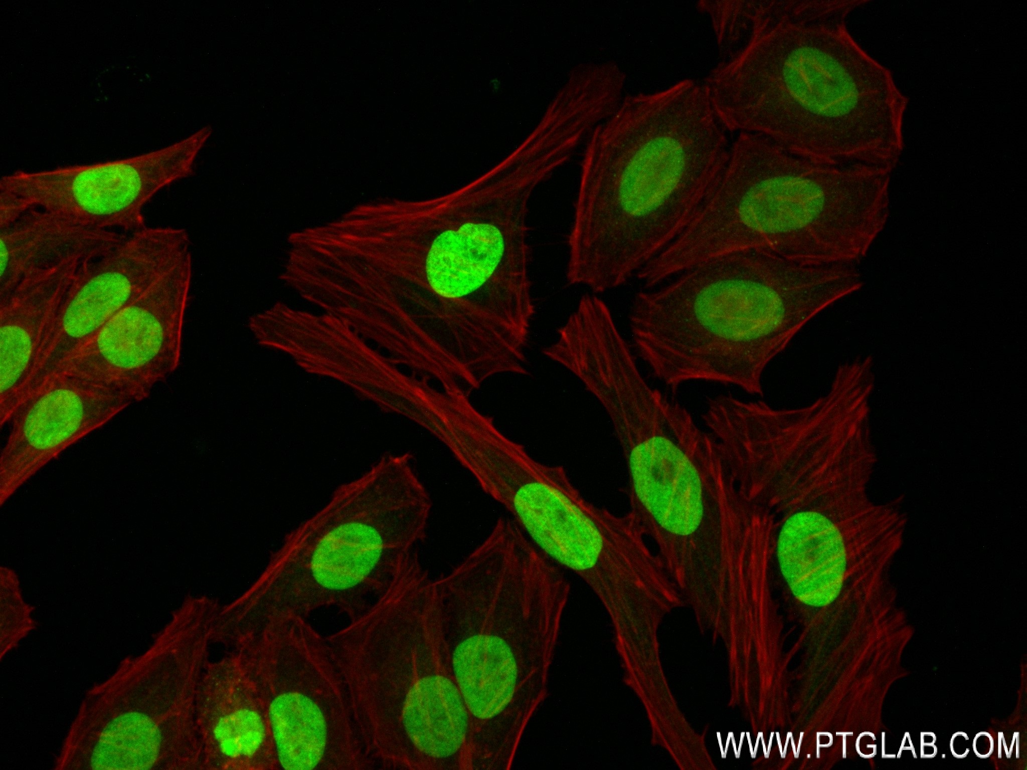 IF Staining of HepG2 using 83993-4-RR (same clone as 83993-4-PBS)