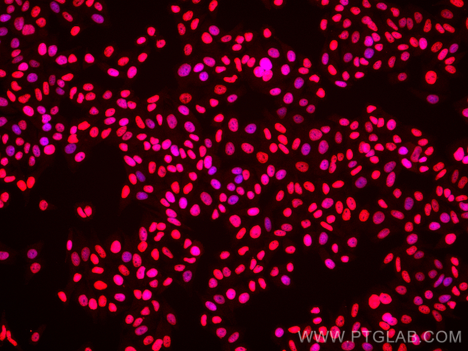 IF Staining of HepG2 using 68888-1-Ig (same clone as 68888-1-PBS)