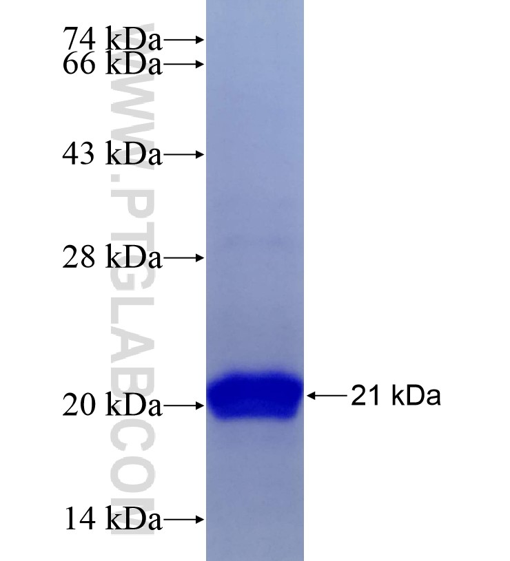 Histone H2A.X fusion protein Ag19289 SDS-PAGE