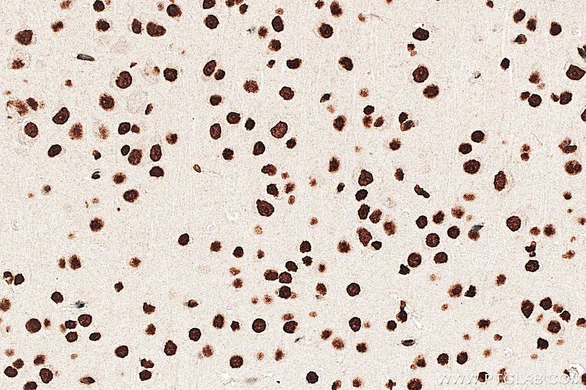 IHC staining of mouse brain using 33612-1-AP