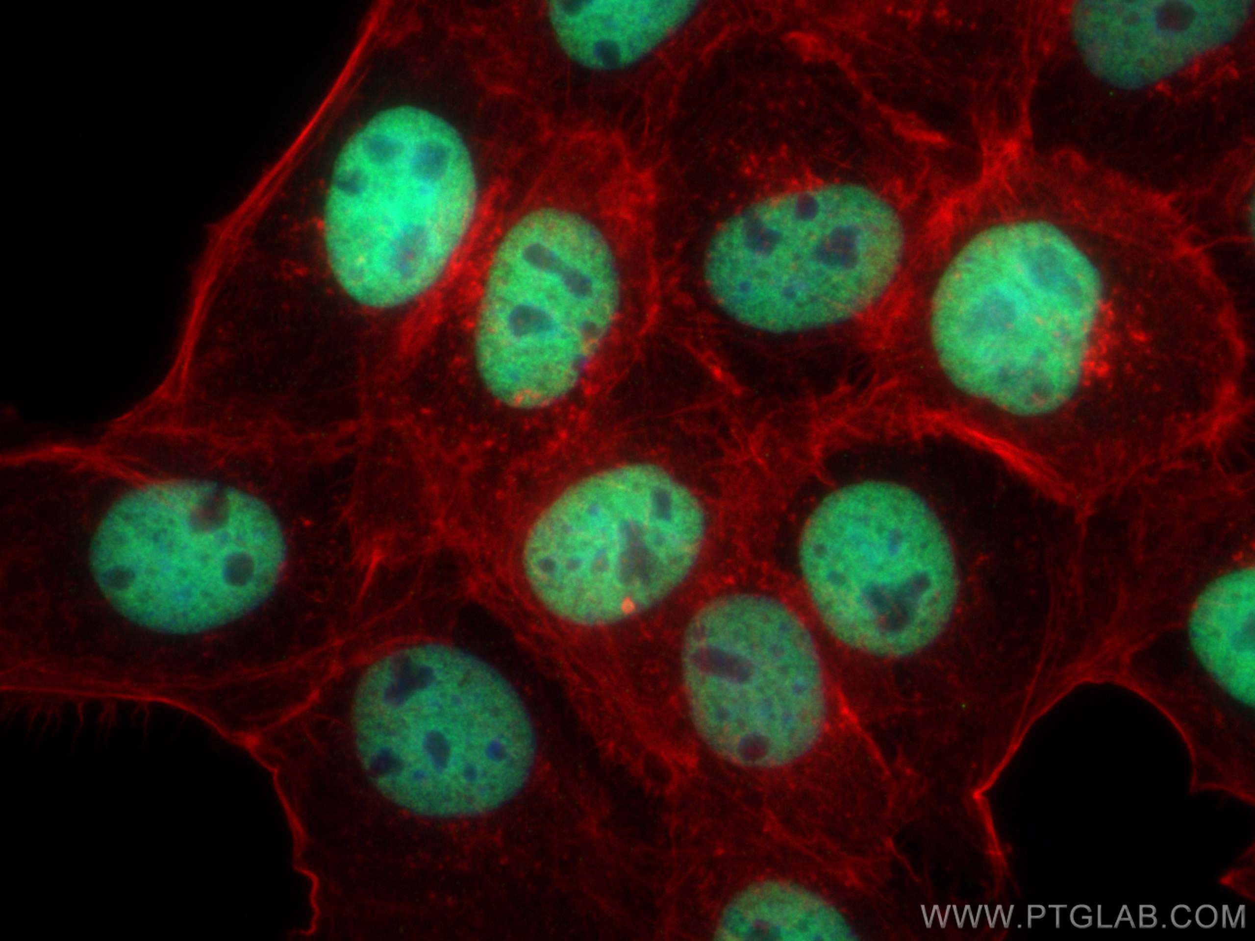 IF Staining of A431 using 68345-1-Ig (same clone as 68345-1-PBS)