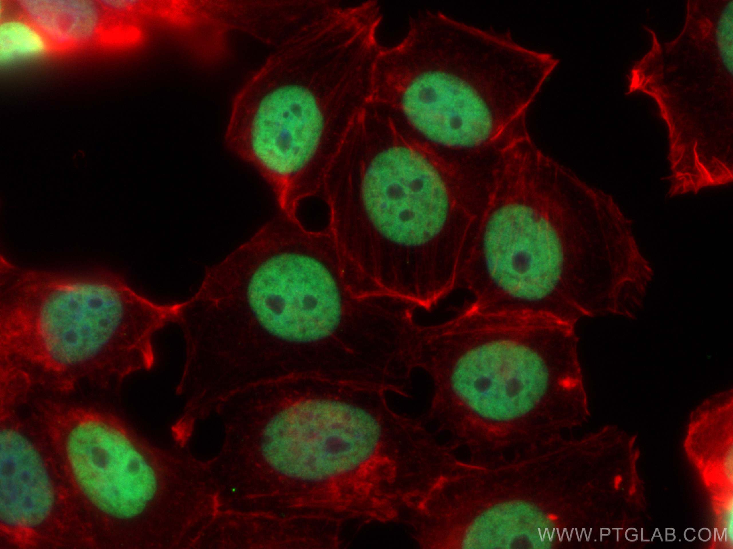 IF Staining of MCF-7 using 68345-1-Ig (same clone as 68345-1-PBS)